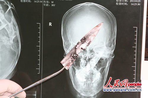 ����һ����­�ڲص�4���漣���(ͼ)